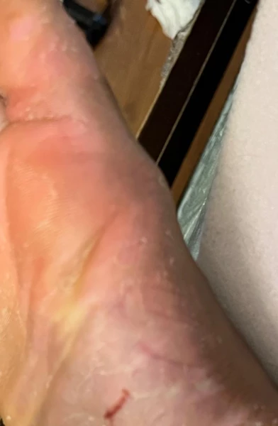 LL Feet