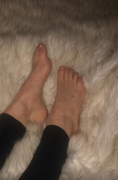 Feet.y