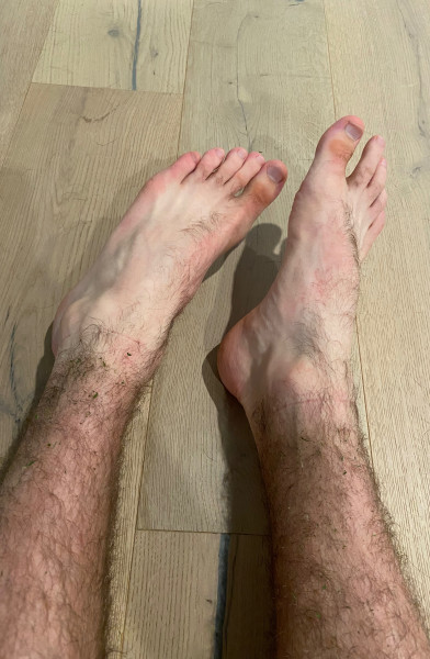 Mr. Hairy Feet &amp; Legs