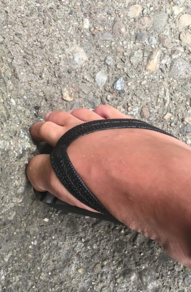 Throbbing big toe