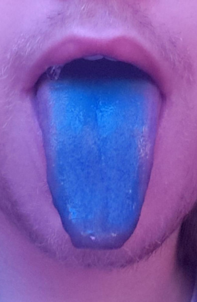 Blue Tongued Skank