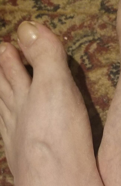 MeesterFeet