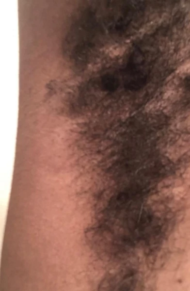 Hairydoll
