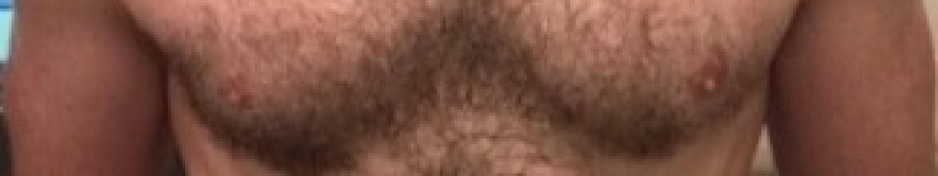 Background hairy_rhody