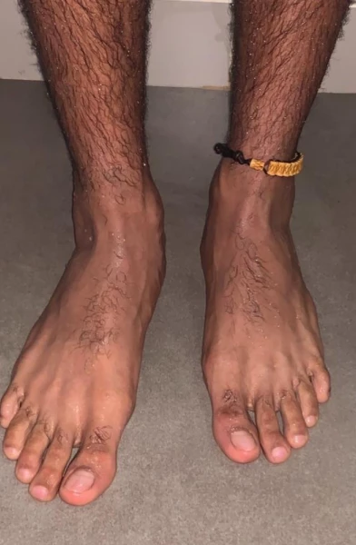 Dominican Feet