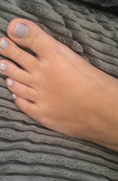 ToetallyFeet