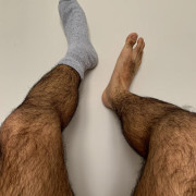 My Hairy Legs