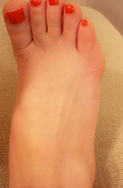 Toesies5