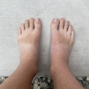 Guy with feet and toes