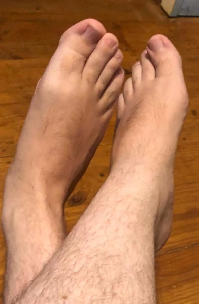 Australian Foot Guy
