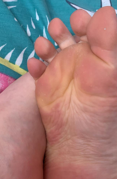 Nursingfeet2021