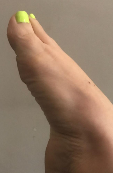 Squishy_feet