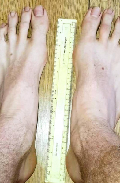 GIANTFEETMALE