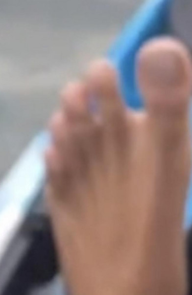 oside toes